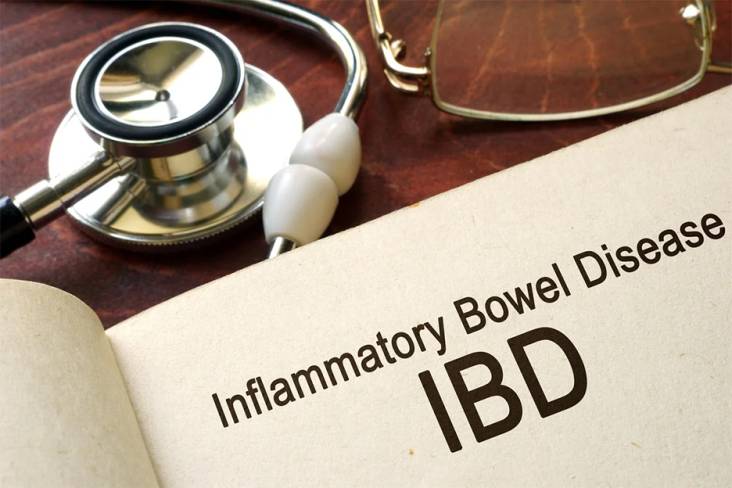 Mengenal Inflammatory Bowel Disease, Penyakit yang dimaksud dimaksud Kerap Terabaikan namun Bisa Akibatkan Komplikasi kemudian juga Kematian